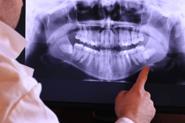 Best Emergency Dental Surgery in Pender, NE
